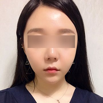 고객 셀카 — 정면 긴 생머리 여성(눈 모자이크)