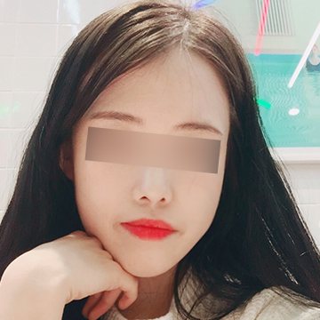 고객 셀카 — 손을 턱에 괸 여성(눈 모자이크)