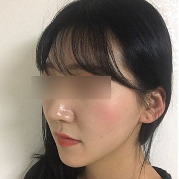 고객 셀카 — 앞머리 있는 여성 옆모습(눈 모자이크)