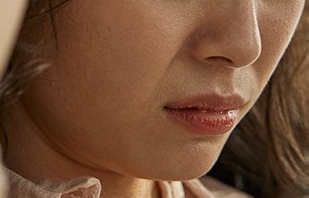 고개를 숙인 여성 옆얼굴 — 코와 입 부분 클로즈업(시술대상: 인상이 강하고 어둡거나 사나워 보이는 경우)